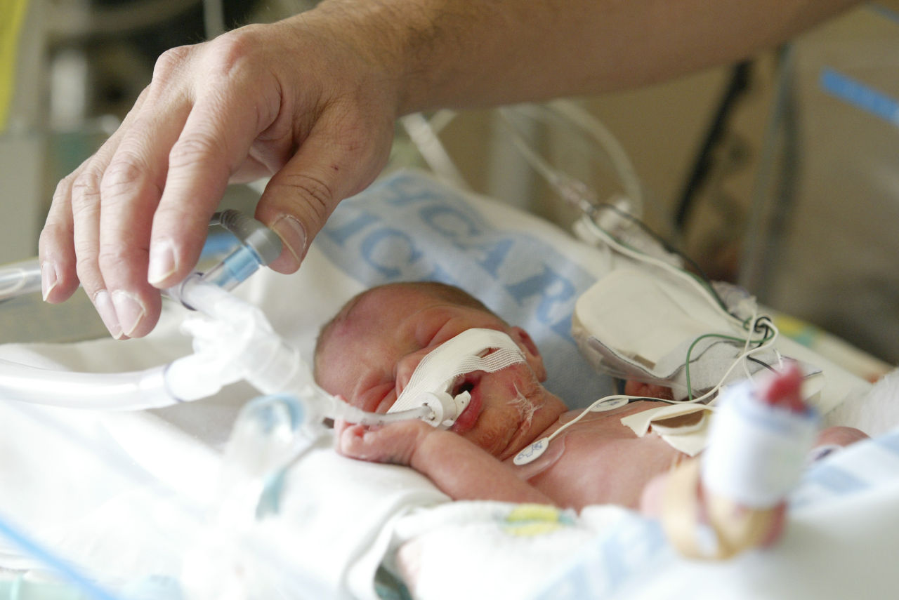 Calls For Better Pain Relief Measures For Newborns, Premature Infants