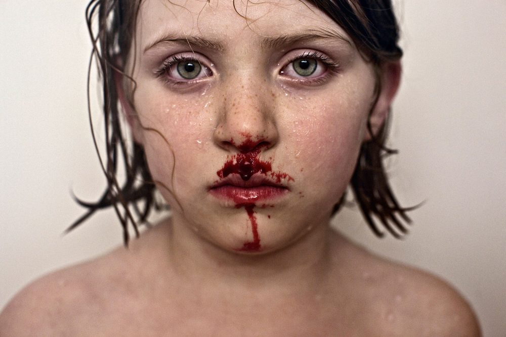 Jesse Burke, "Flesh and Blood," 2012. (Courtesy Gallery Kayafas)