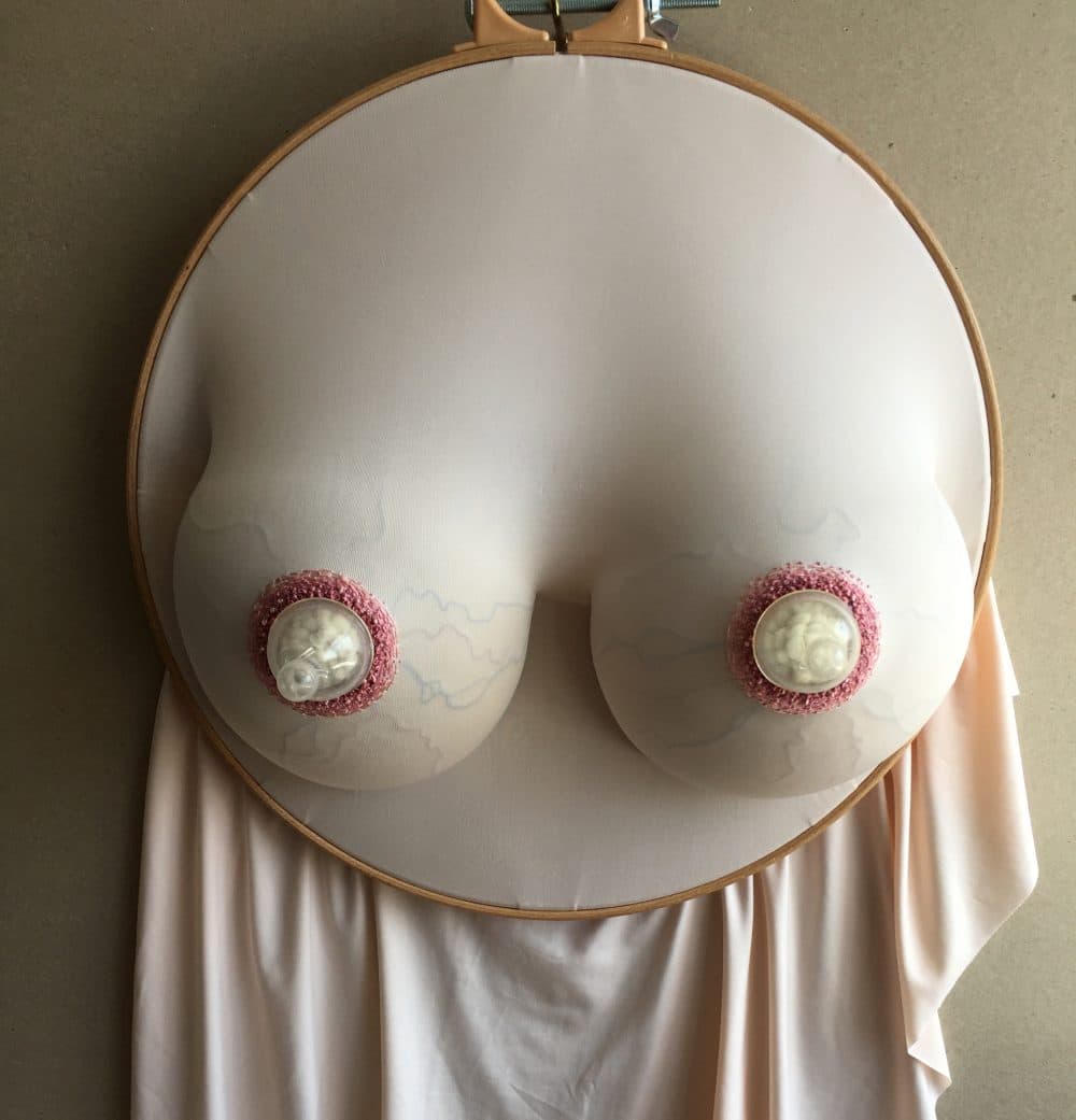Sally Hewett's "Teet Transplant." (Courtesy Sally Hewett)