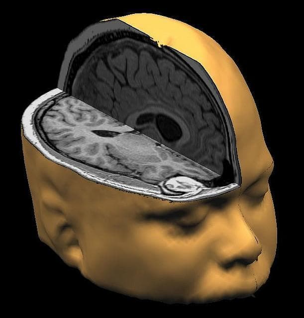 This Is Your Brain On Poverty With >> Your Brain On Poverty Low Income Childhood Linked To Smaller Brain This Is Your Brain On Poverty With >> Your Brain On Poverty Low Income Childhood Linked To Smaller Brain