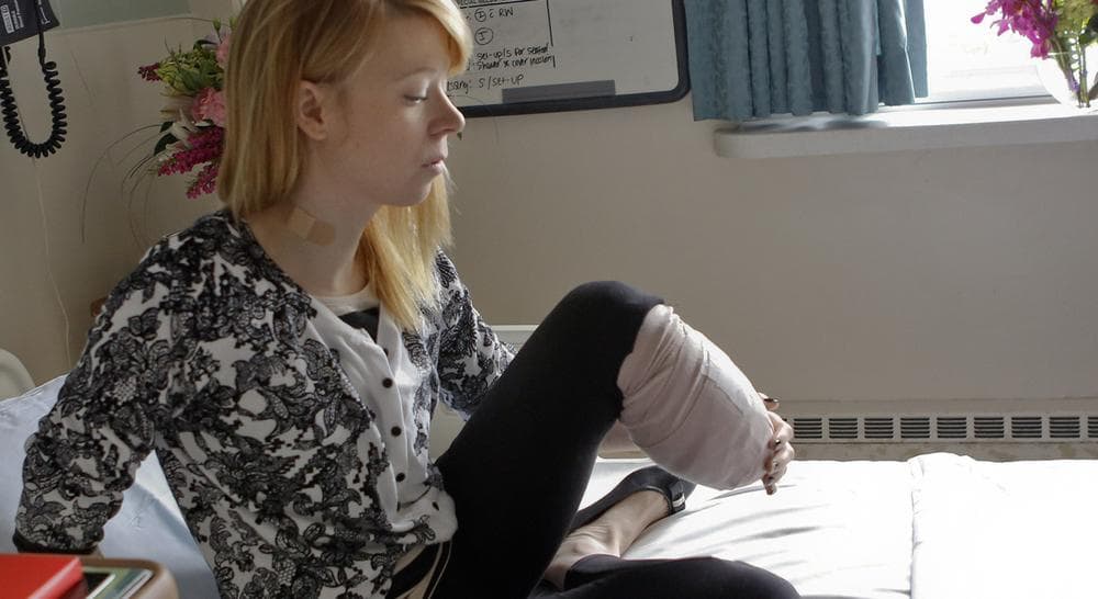 Adrianne Haslet, a professional ballroom dancer injured by one of the bombs that exploded near the Boston Marathon finish line, lifts her bandaged left leg in her bed at Spaulding Rehabilitation Hospital in Boston, Wednesday, April 24, 2013. Haslet, who lost her left foot and part of her lower leg, vows that she will dance again. (Bizuayehu Tesfaye/AP)