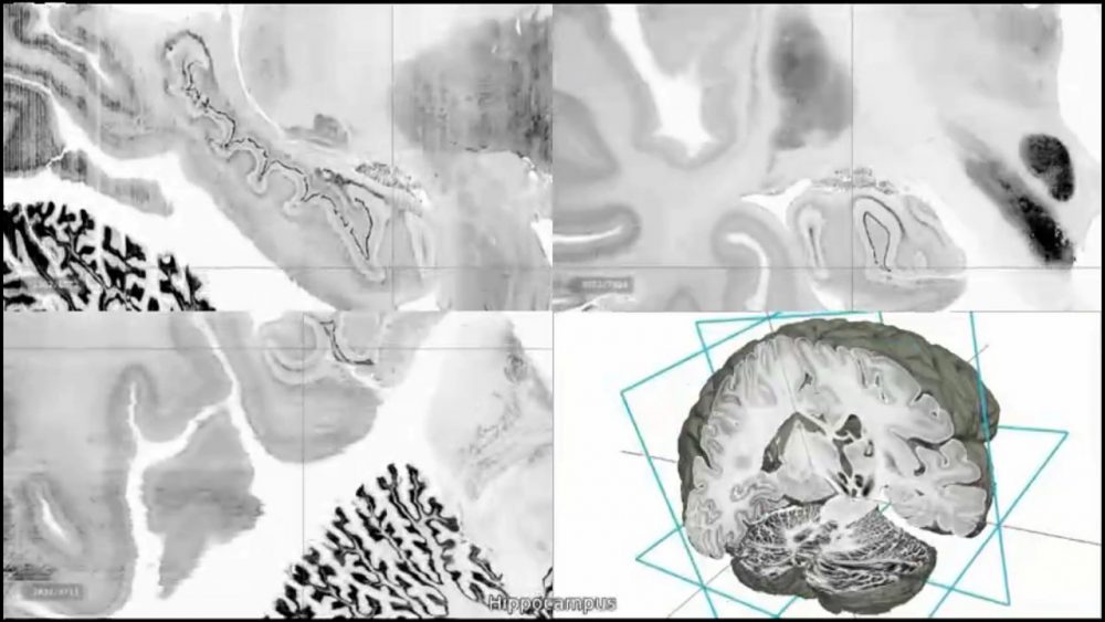 This image made from video provided by researchers shows a highly-detailed image of the hippocampus region of the human brain. The digital three-dimensional model called "BigBrain" was produced from the thousands of sections made from the brain of a 65-year-old woman. Its resolution is finer than a human hair, so it can reveal clusters of brain cells and even some large individual cells. (AP)