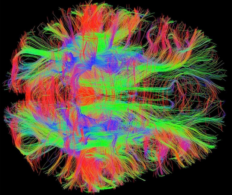 how many neurons in the human brain