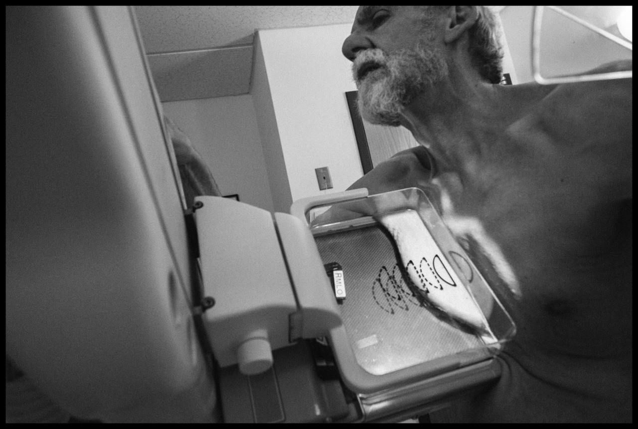 My Right Breast One Man's Tale Of Lump And Mammogram