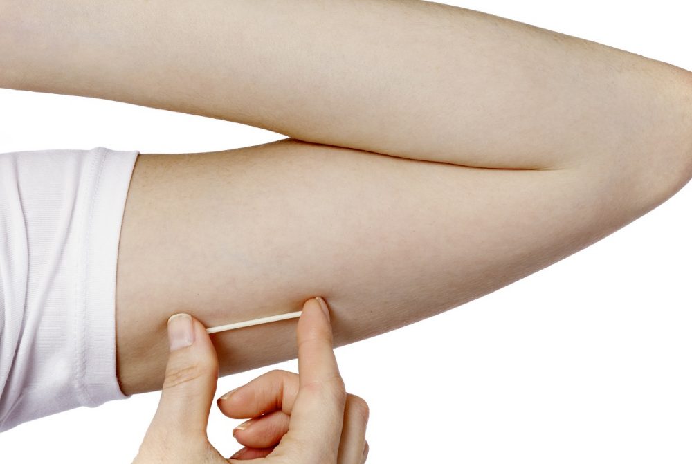 A model holds the Nexplanon hormonal implant for birth control. Teen girls who have sex should use IUDs or hormonal implants long-acting birth control methods that are effective, safe and easy to use, the nation's most influential pediatricians' group recommends. (Merck/AP)
