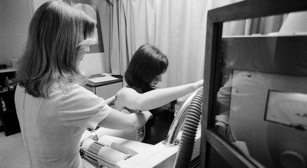 Having dense breast tissue can make mammograms hard to read, and may increase the risk of breast cancer. (American Cancer Society/AP)