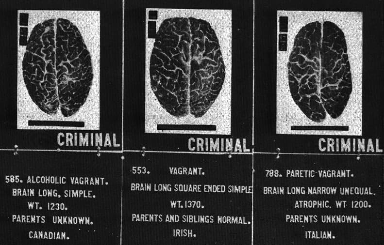 Long brain. Патологии мозга преступников. Мозг преступника 82 пугающие головоломки.