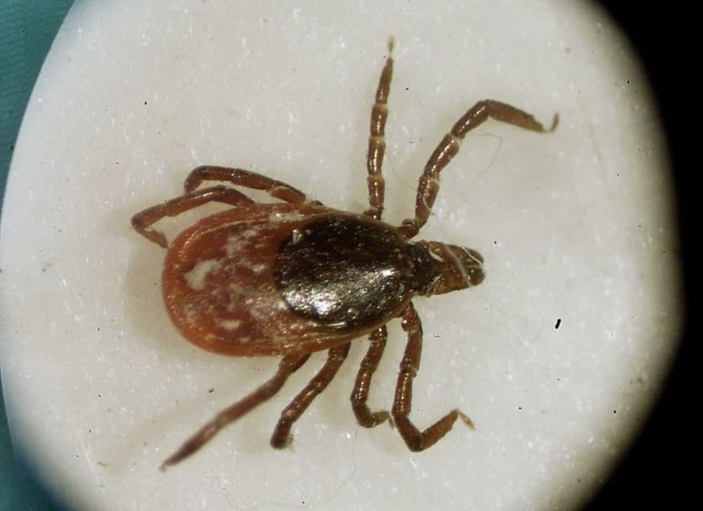 A deer tick under a microscope in the entomology lab at the University of Rhode Island in South Kingstown, R.I. (Victoria Arocho/AP)