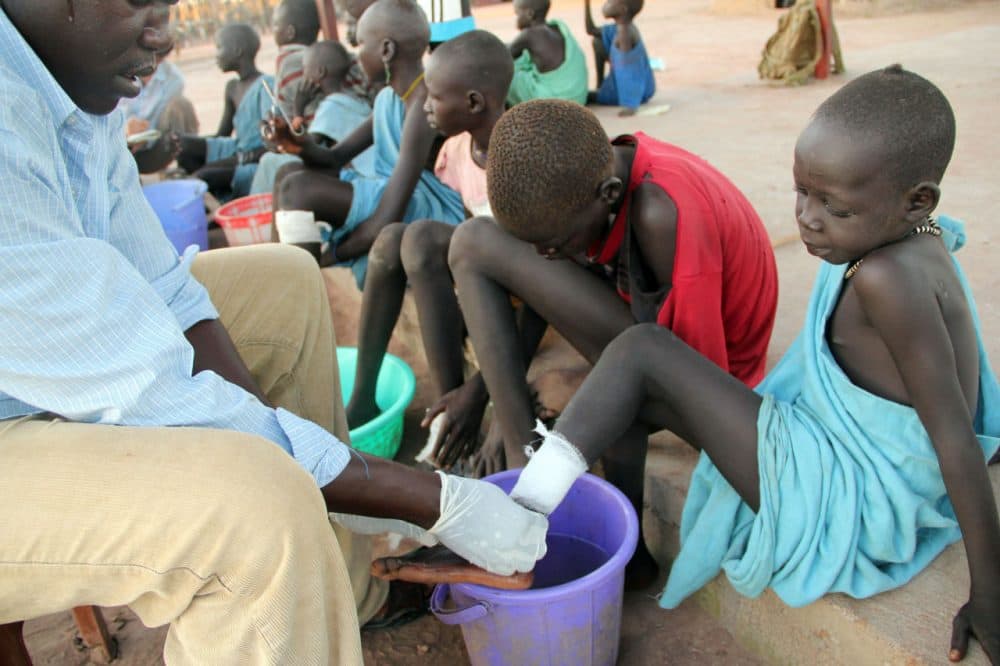 Ajak Kuol Nyamchiek, 7, watches while John Lotiki, a nurse with the Carter Center, bandages the blister on her leg from where a guinea worm is slowly emerging in Abuyong, Sudan, Nov. 4, 2010. Nyamchiek is a patient at Center’s guinea worm case containment center. Nurses at this center in Abuyong, a village in Awerial County in Southern Sudan’s Lakes state, bandage the worms twice daily, after gently pulling the worms out several inches each time. If they break while they are being pulled out of the swollen blisters, the wounds become infected and the worms withdraw back into the body, prolonging the pain for the victims. (Maggie Fick/AP)
