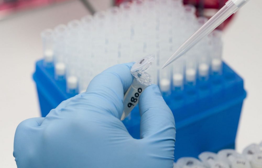 A medical researcher works on results of tests for various diseases, including Zika, at the Gorgas Memorial laboratory Panama City, Friday, Feb. 5, 2016. Panamanian authorities announced Monday that 50 cases of the Zika virus infection have been detected in Panama's sparsely populated Guna Yala indigenous area along the Caribbean coast where they are conducting an aggressive campaign to contain the spread of the virus. (Arnulfo Franco/AP)