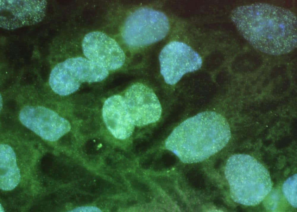 Stem cells seen on a computer screen at the University of Connecticut's Stem Cell Institute at the UConn Health Center on Aug. 27, 2010 in Farmington, Conn. (Spencer Platt/Getty Images)
