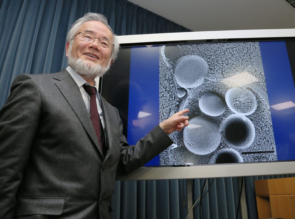 This photo taken on March 25, 2015 shows Japanese scientist Yoshinori Ohsumi speaking during a press conference at the Ministry Of Education in Tokyo. Ohsumi won the Nobel Medicine Prize for his work on autophagy -- a process whereby cells "eat themselves" -- which when disrupted can cause Parkinson's and diabetes. (Jiji Press/AFP/Getty Images)