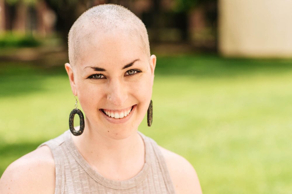 Katie Koppel lives with trichotillomania, the compulsion of pulling out one's own hair. The condition belongs to a broader group of disorders, called body-focused repetitive behaviors, that are estimated to affect 1 to 3 percent of the population. (Courtesy of Jillian Clark)
