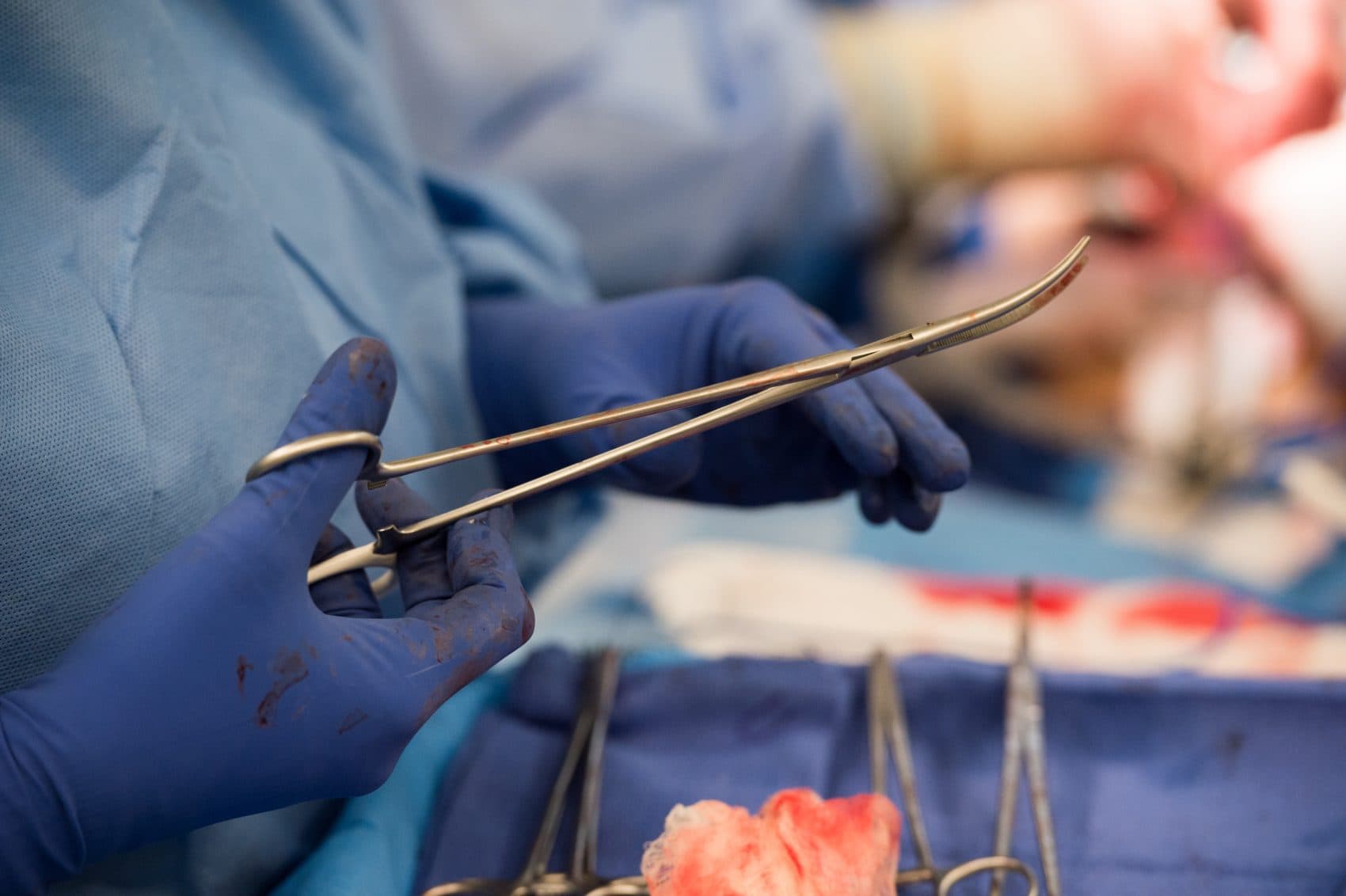 Are There Benefits To Meniscus Surgery? | Here & Now