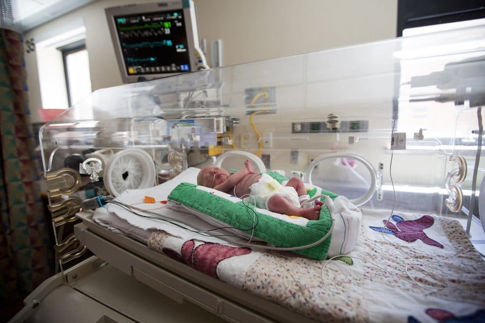 A baby rests in the Neonatal Intensive Care Unit at Tufts Medical Center after being born more than 11 weeks premature. (Jesse Costa/WBUR)