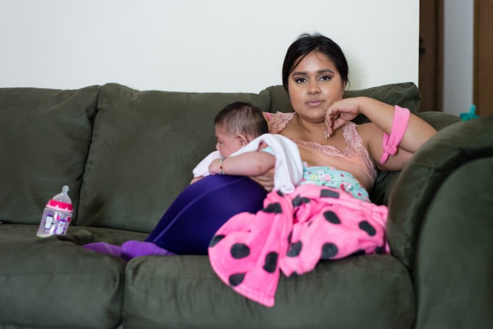 Maria Rios, 20, holds her daughter Aryanna Guadalupe Sanchez-Rios, who was born with microcephaly, on May 3, 2017. Maria, a U.S. citizen, was infected with the mosquito-borne Zika virus while she was living with her husband in Colima, Mexico, last year. (Heidi de Marco/KHN)