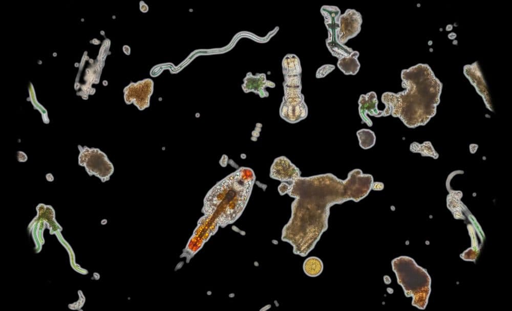 From Blue Cheese To Dirt, How Beautiful Bacteria Can Be ...