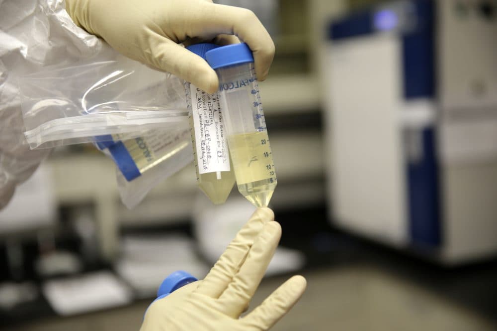 In this file photo, quality control manager Nina Kotlyarova prepares to check samples for unwanted bacteria as part of the process for making an influenza vaccine at Protein Sciences in New York in 2015. (Seth Wenig/AP)