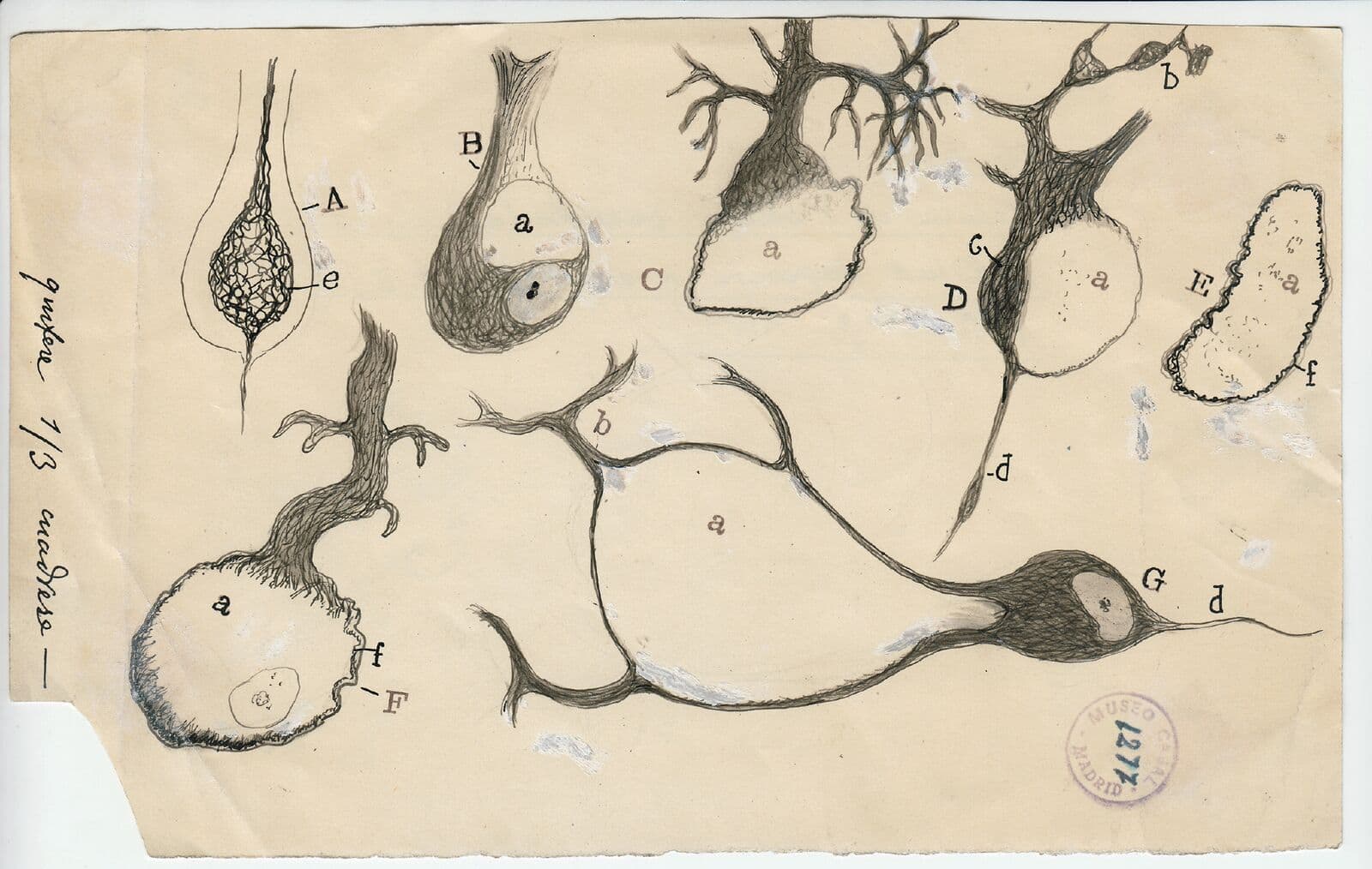 Santiago Ramón y Cajal's ink and pencil drawing of injured Purkinje neurons, created in 1914. (Courtesy of Instituto Cajal)