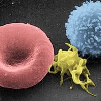 A platelet (yellow) is flanked by a red blood cell (left) and a white blood cell (right) in this electron microscope view. (WikiMedia Commons)