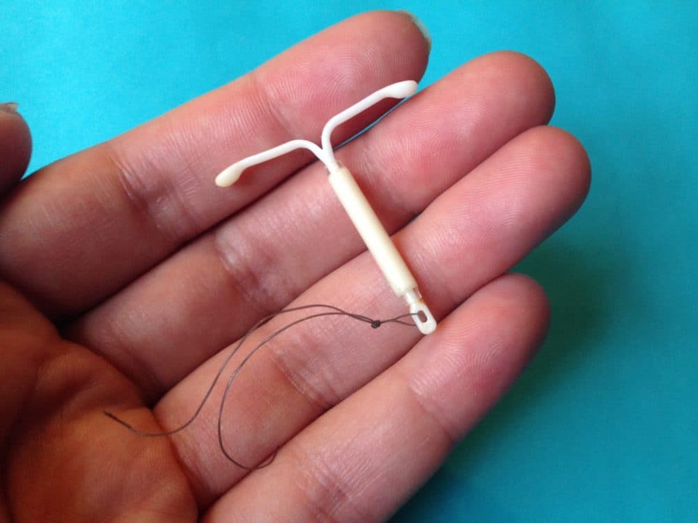 iud birth control