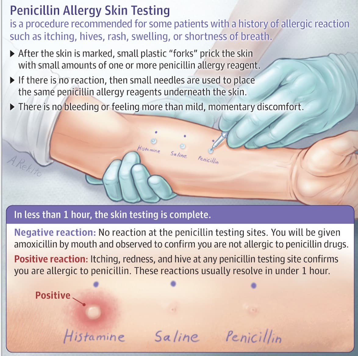 What to do if you have a reaction to penicillin