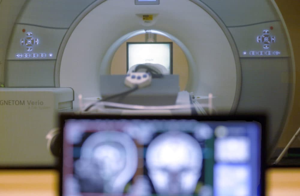 New Device Could Reduce Mri Scanning Times From An Hour To 5 Minutes 5021