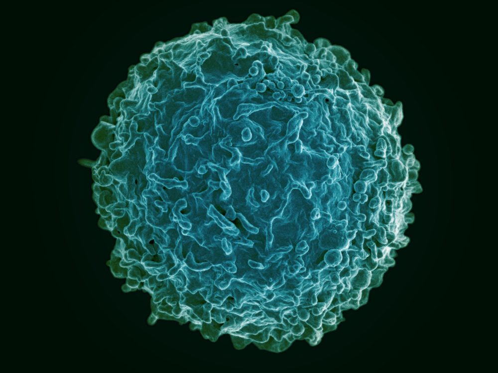 Colorized scanning electron micrograph of a B cell from a human donor. These cells produce antibodies that fight infections. (Courtesy NIAID)