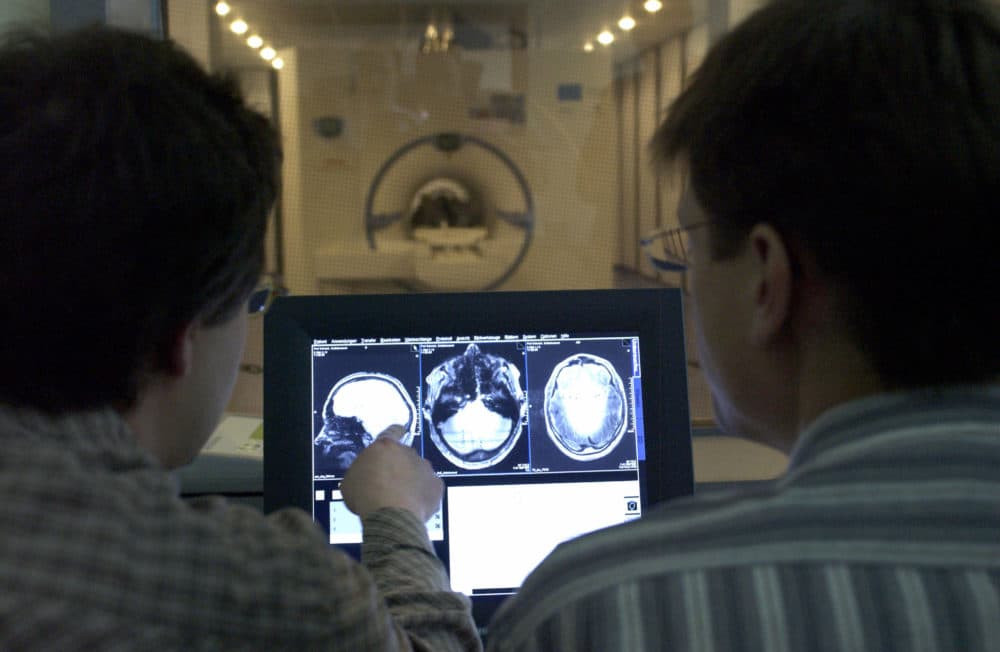 Some patients have had success treating movement disorders with neurostimulators — devices implanted in the brain during a procedure called deep brain stimulation surgery. (Jens Schlueter/DDP/AFP via Getty Images)