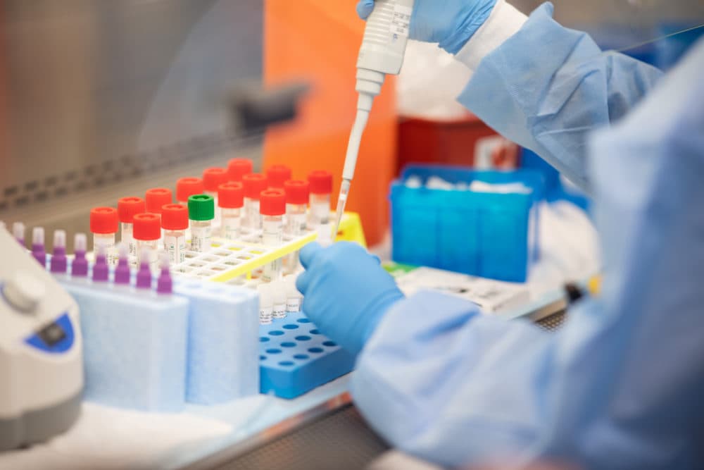A lab technician begins semi-automated testing for COVID-19 at Northwell Health Labs on March 11, 2020 in Lake Success, New York. (Andrew Theodorakis/Getty Images)