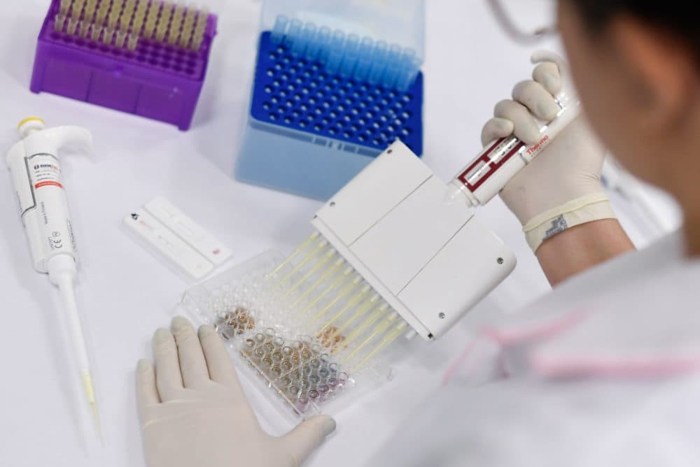 A researcher works on the diagnosis of suspected coronavirus COVID-19 cases in Belo Horizonte, state of Minas Gerais, Brazil, on March 26, 2020. (DOUGLAS MAGNO/AFP via Getty Images)
