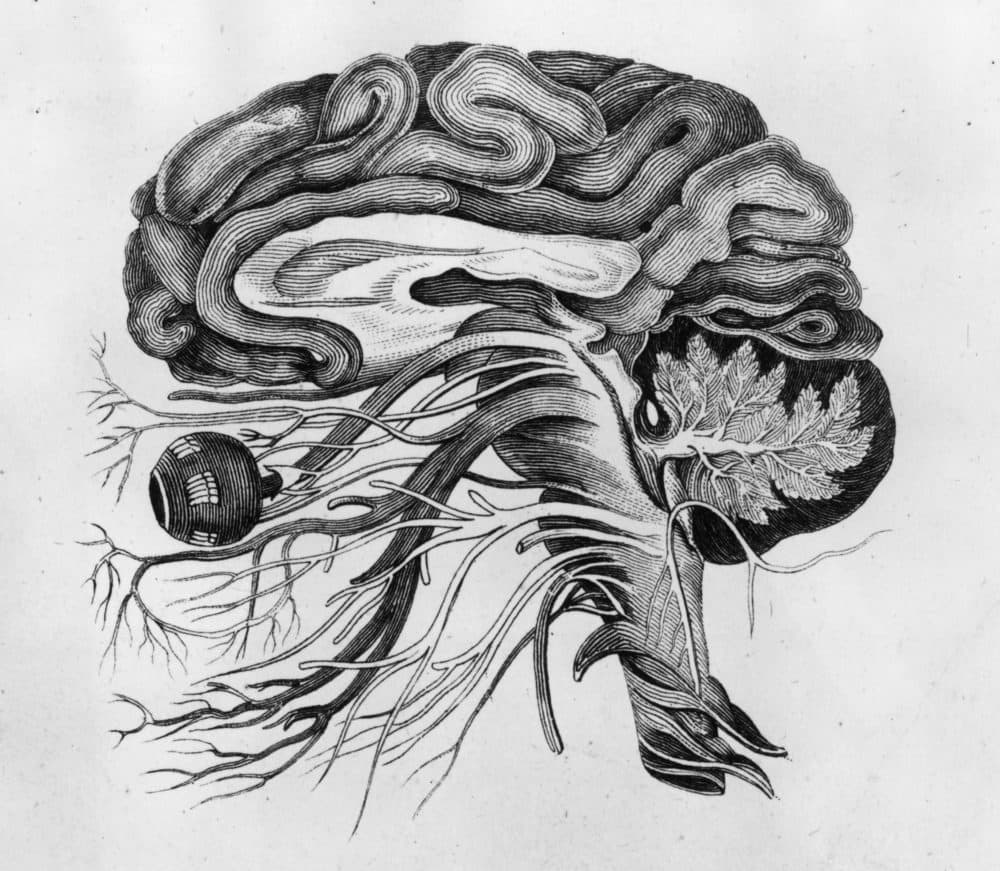 Anatomical drawing of the human brain and cerebral nerves. (Hulton Archive/Getty Images)